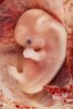 1200px-9-Week_Human_Embryo_from_Ectopic_Pregnancy.jpg